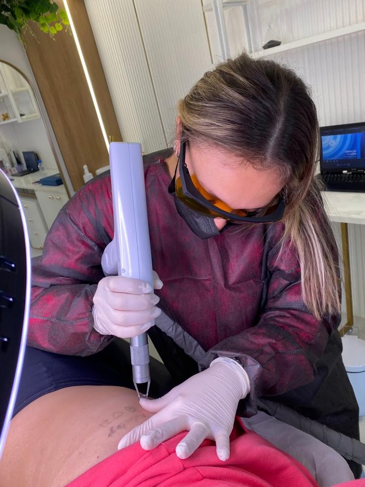 Carolline Moura durante procedimento de remoção de micropigmentação a laser